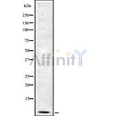 Western blot analysis of Defensin ?2 using HuvEc whole cell lysates