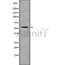 Western blot analysis of EAAT1 using COLO205 whole cell lysates