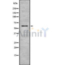 Western blot analysis of EAAT2 using HT29 whole cell lysates