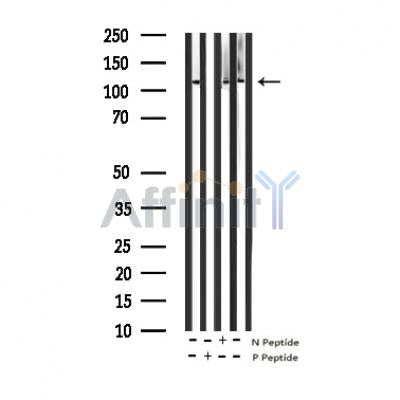 AF3023 staining K562 by IF/ICC. The sample were fixed with PFA and permeabilized in 0.1% Triton X-100,then blocked in 10% serum for 45 minutes at 25¡ãC. The primary antibody was diluted at 1/200 and incubated with the sample for 1 hour at 37¡ãC. An  Alexa Fluor 594 conjugated goat anti-rabbit IgG (H+L) Ab, diluted at 1/600, was used as the secondary antibod