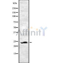 Western blot analysis of EF-1? using HT29 whole cell lysates