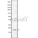 Western blot analysis of eIF5A2 using Jurkat whole cell lysates