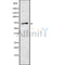 Western blot analysis of extracts from HepG2, using ENaC ? Antibody.