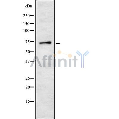 Western blot analysis of extracts from HepG2, using ENaC ? Antibody.