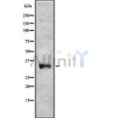 Western blot analysis of Endo G using HepG2 whole cell lysates