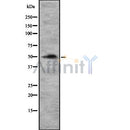 Western blot analysis of ENT1 using Jurkat whole cell lysates
