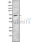 Western blot analysis of EOMES using HuvEc whole cell lysates