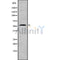 Western blot analysis GCK using K562 whole cell lysates