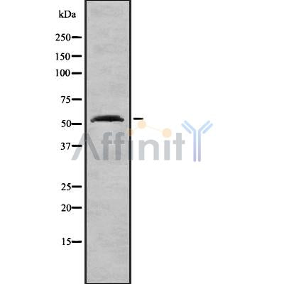 Western blot analysis GCK using K562 whole cell lysates