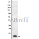 DF8553 at 1/100 staining Mouse kidney tissue by IHC-P. The sample was formaldehyde fixed and a heat mediated antigen retrieval step in citrate buffer was performed. The sample was then blocked and incubated with the antibody for 1.5 hours at 22¡ãC. An HRP conjugated goat anti-rabbit antibody was used as the secondary