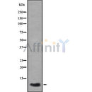 DF8554 at 1/100 staining Mouse kidney tissue by IHC-P. The sample was formaldehyde fixed and a heat mediated antigen retrieval step in citrate buffer was performed. The sample was then blocked and incubated with the antibody for 1.5 hours at 22¡ãC. An HRP conjugated goat anti-rabbit antibody was used as the secondary