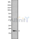 Western blot analysis of HES2 using LOVO whole cell lysates