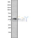 Western blot analysis of HLA Class I using A549 whole cell lysates