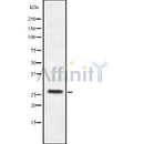 Western blot analysis of HoxB4 using Jurkat whole cell lysates