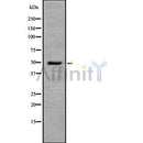 DF8561 staining HepG2? cells by IF/ICC. The sample were fixed with PFA and permeabilized in 0.1% Triton X-100,then blocked in 10% serum for 45 minutes at 25¡ãC. The primary antibody was diluted at 1/200 and incubated with the sample for 1 hour at 37¡ãC. An  Alexa Fluor 594 conjugated goat anti-rabbit IgG (H+L) antibody(Cat.