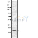 DF8564 at 1/100 staining Mouse kidney tissue by IHC-P. The sample was formaldehyde fixed and a heat mediated antigen retrieval step in citrate buffer was performed. The sample was then blocked and incubated with the antibody for 1.5 hours at 22¡ãC. An HRP conjugated goat anti-rabbit antibody was used as the secondary