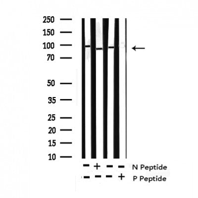 AF3026 staining HuvEc by IF/ICC. The sample were fixed with PFA and permeabilized in 0.1% Triton X-100,then blocked in 10% serum for 45 minutes at 25¡ãC. The primary antibody was diluted at 1/200 and incubated with the sample for 1 hour at 37¡ãC. An  Alexa Fluor 594 conjugated goat anti-rabbit IgG (H+L) Ab, diluted at 1/600, was used as the secondary antibod