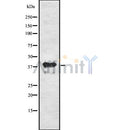 Western blot analysis of extracts from Mouse  lung, using Inhibin beta-C Antibody. The lane on the left was treated with blocking peptide.