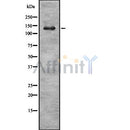 Western blot analysis of extracts from Mouse Myeloma cell, using MaxiK alpha Antibody. Lane 1 was treated with the blocking peptide.