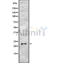 Western blot analysis of extracts from COS-7, using MaxiK? Antibody. The lane on the left was treated with blocking peptide.