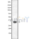 Western blot analysis of ML-IAP using K562 whole cell lysates