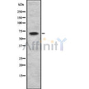 Western blot analysis of extracts from mouse brain, using Netrin-1 Antibody. Lane 1 was treated with the antigen-specific peptide.