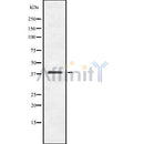 Western blot analysis of extracts from mouse brain, using OBCAM Antibody.