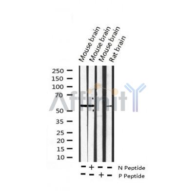 AF3029 staining HeLa by IF/ICC. The sample were fixed with PFA and permeabilized in 0.1% Triton X-100,then blocked in 10% serum for 45 minutes at 25¡ãC. The primary antibody was diluted at 1/200 and incubated with the sample for 1 hour at 37¡ãC. An  Alexa Fluor 594 conjugated goat anti-rabbit IgG (H+L) Ab, diluted at 1/600, was used as the secondary antibod