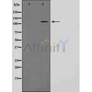 Western blot analysis of OPA1 Antibody expression in A431 cells lysates.