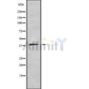 DF8591 at 1/100 staining Mouse kidney tissue by IHC-P. The sample was formaldehyde fixed and a heat mediated antigen retrieval step in citrate buffer was performed. The sample was then blocked and incubated with the antibody for 1.5 hours at 22¡ãC. An HRP conjugated goat anti-rabbit antibody was used as the secondary