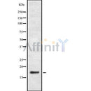 Western blot analysis of extracts from Hepg2, using PGE synthase Antibody. Lane 1 was treated with the blocking peptide.