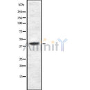 Western blot analysis of Podocin using HuvEc whole cell lysates