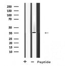 DF8594 staining Hela cells by IF/ICC. The sample were fixed with PFA and permeabilized in 0.1% Triton X-100,then blocked in 10% serum for 45 minutes at 25¡ãC. The primary antibody was diluted at 1/200 and incubated with the sample for 1 hour at 37¡ãC. An  Alexa Fluor 594 conjugated goat anti-rabbit IgG (H+L) antibody(Cat.