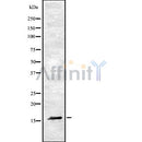 Western blot analysis of RAMP1 using HuvEc whole cell lysates