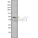 Western blot analysis of extracts from Mouse  brain, using RBMS3 Antibody. The lane on the left was treated with blocking peptide.