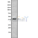 DF8600 at 1/100 staining Rat lung tissue by IHC-P. The sample was formaldehyde fixed and a heat mediated antigen retrieval step in citrate buffer was performed. The sample was then blocked and incubated with the antibody for 1.5 hours at 22¡ãC. An HRP conjugated goat anti-rabbit antibody was used as the secondary
