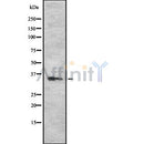 DF8605 at 1/100 staining Human brain cancer tissue by IHC-P. The sample was formaldehyde fixed and a heat mediated antigen retrieval step in citrate buffer was performed. The sample was then blocked and incubated with the antibody for 1.5 hours at 22¡ãC. An HRP conjugated goat anti-rabbit antibody was used as the secondary