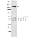 Western blot analysis SCOP using COLO205 whole cell lysates