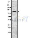 Western blot analysis SEMA3F using COLO205 whole cell lysates