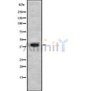 Western blot analysis SP-B using LOVO whole cell lysates