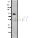 DF8616 at 1/100 staining Mouse colon tissue by IHC-P. The sample was formaldehyde fixed and a heat mediated antigen retrieval step in citrate buffer was performed. The sample was then blocked and incubated with the antibody for 1.5 hours at 22¡ãC. An HRP conjugated goat anti-rabbit antibody was used as the secondary