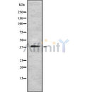 DF8618 at 1/100 staining Human prostate tissue by IHC-P. The sample was formaldehyde fixed and a heat mediated antigen retrieval step in citrate buffer was performed. The sample was then blocked and incubated with the antibody for 1.5 hours at 22¡ãC. An HRP conjugated goat anti-rabbit antibody was used as the secondary