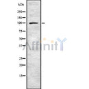 DF8619 at 1/100 staining Mouse spleen tissue by IHC-P. The sample was formaldehyde fixed and a heat mediated antigen retrieval step in citrate buffer was performed. The sample was then blocked and incubated with the antibody for 1.5 hours at 22¡ãC. An HRP conjugated goat anti-rabbit antibody was used as the secondary