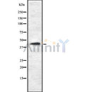 Western blot analysis of TASK-1 using Jurkat whole cell lysates