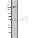Western blot analysis of Tensin-1 using HuvEc whole cell lysates