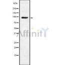 Western blot analysis of extracts from rat brain, using TRPV4 Antibody.