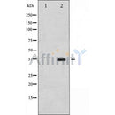 DF8626 at 1/100 staining Mouse muscle tissue by IHC-P. The sample was formaldehyde fixed and a heat mediated antigen retrieval step in citrate buffer was performed. The sample was then blocked and incubated with the antibody for 1.5 hours at 22¡ãC. An HRP conjugated goat anti-rabbit antibody was used as the secondary