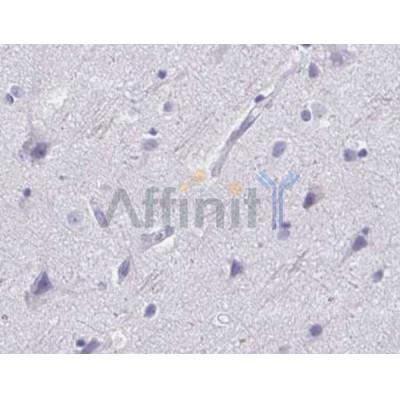 IHC analysis of mouse brain tissue.