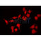 AF0186 staining HuvEc by IF/ICC. The sample were fixed with PFA and permeabilized in 0.1% Triton X-100,then blocked in 10% serum for 45 minutes at 25¡ãC. The primary antibody was diluted at 1/200 and incubated with the sample for 1 hour at 37¡ãC. An  Alexa Fluor 594 conjugated goat anti-rabbit IgG (H+L) Ab, diluted at 1/600, was used as the secondary antibod