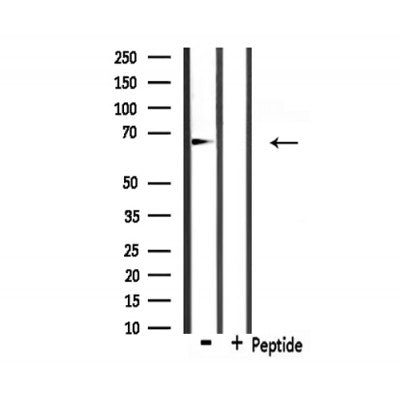 Western blot analysis of extracts from 293, using Involucrin Antibody.
